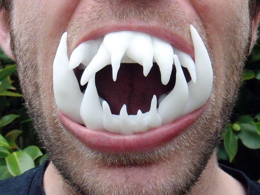 teeth-open.jpg