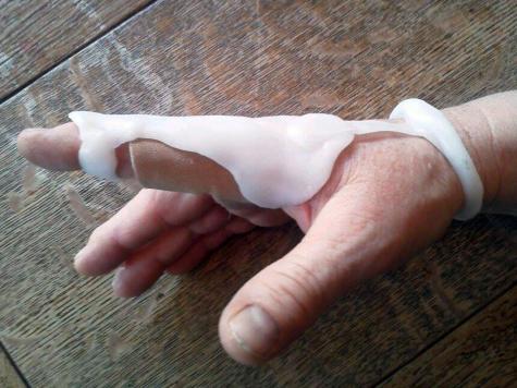 Finger brace