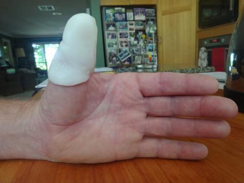 Thumb prosthesis